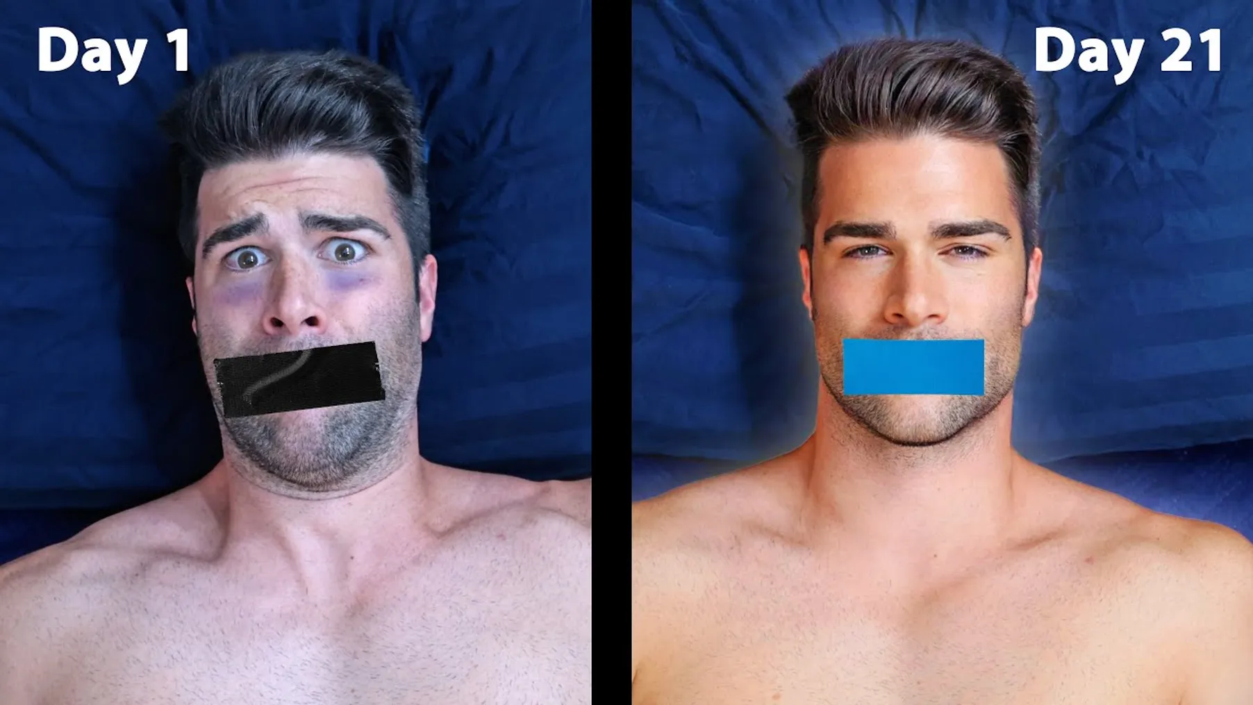 I Taped My Mouth When Sleeping Every Night for 21 Days Preview