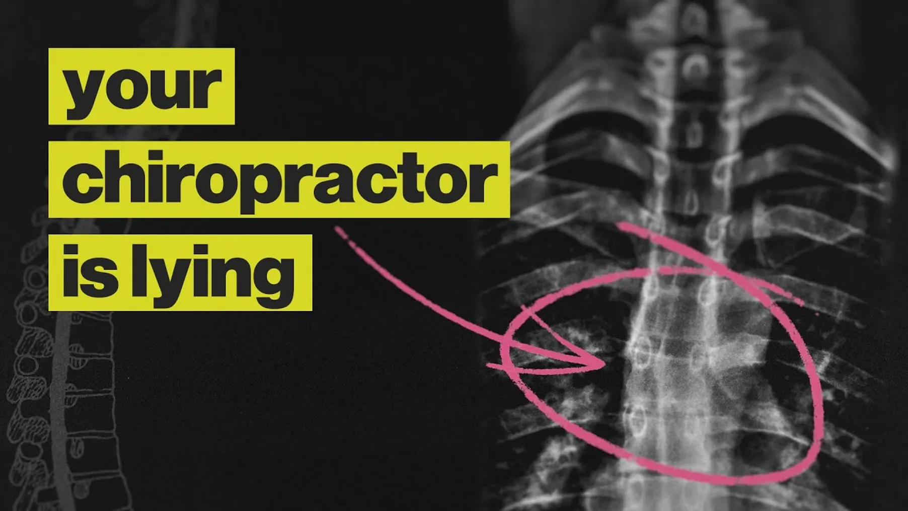 Chiropractors Are Not What You Think They Are Preview