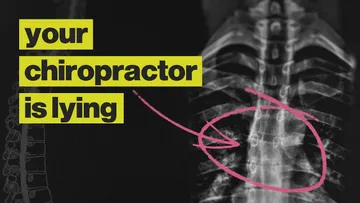 Chiropractors Are Not What You Think They Are Preview